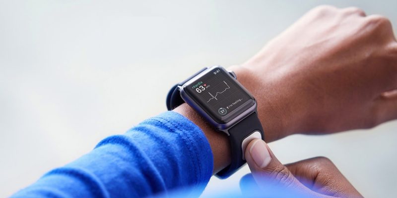 Il prossimo Apple Watch potrebbe avere un vero elettrocardiogramma integrato