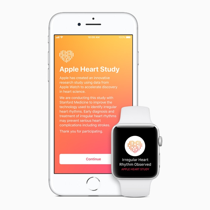 Stanford Medicine ha studiato le capacità dell&#039;ECG di Apple Watch, e i risultati sono decisamente incoraggianti