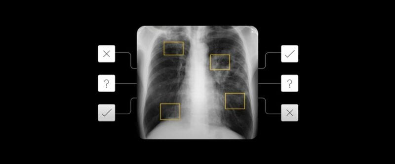Google e la medicina: come la sua IA aiuta la cura di tubercolosi e malattie della pelle (foto)